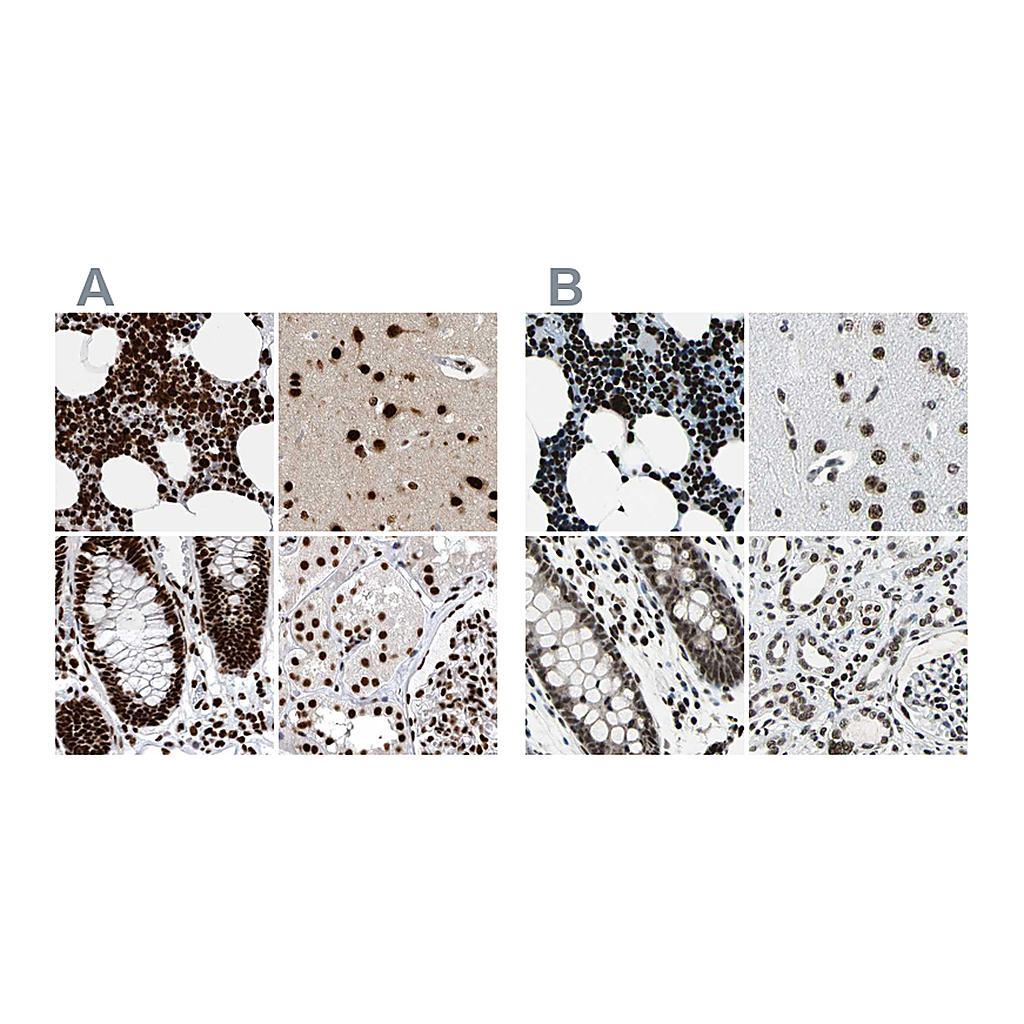 Atlas Antibodies Anti-BCLAF1 Antibody