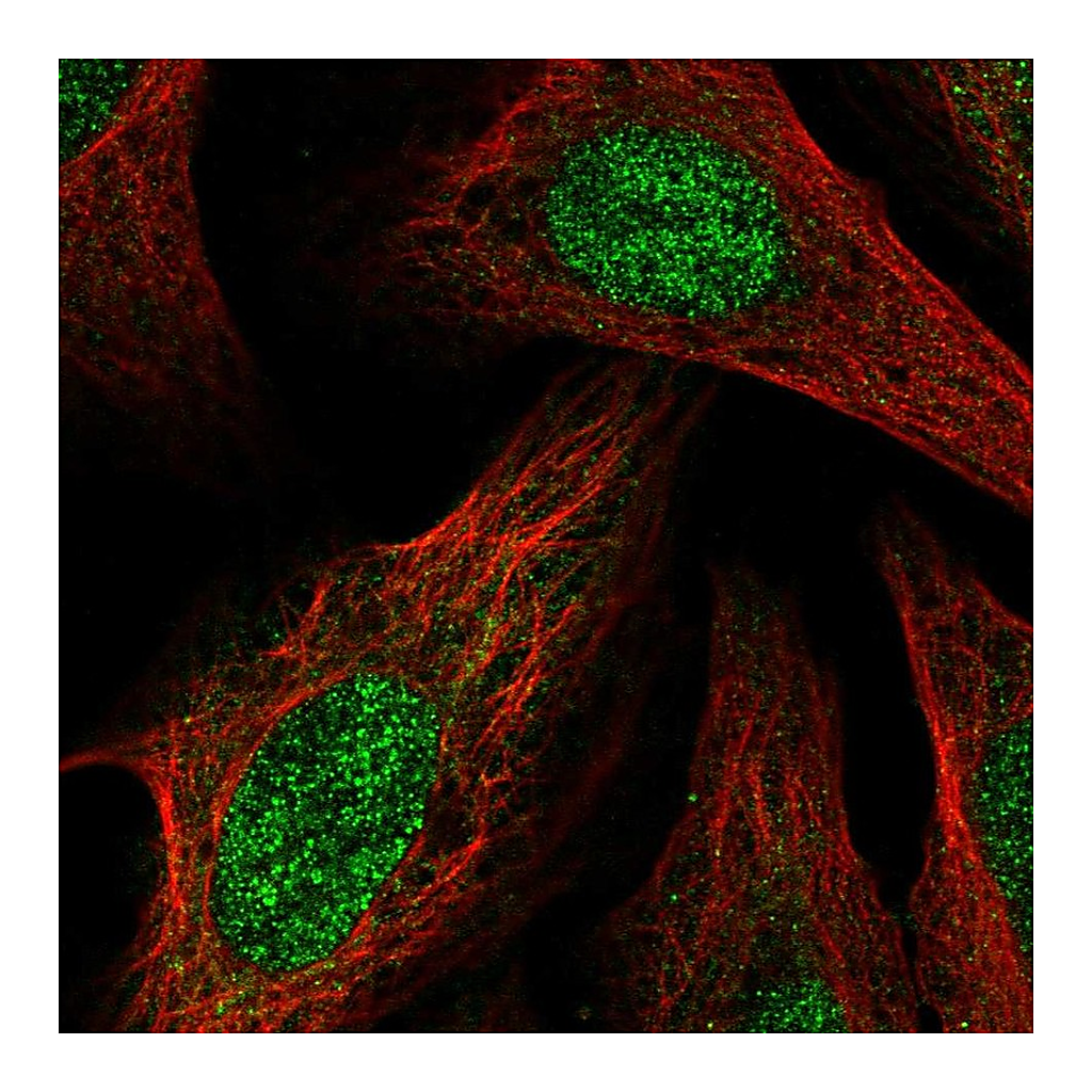Atlas Antibodies Anti-BCOR Antibody