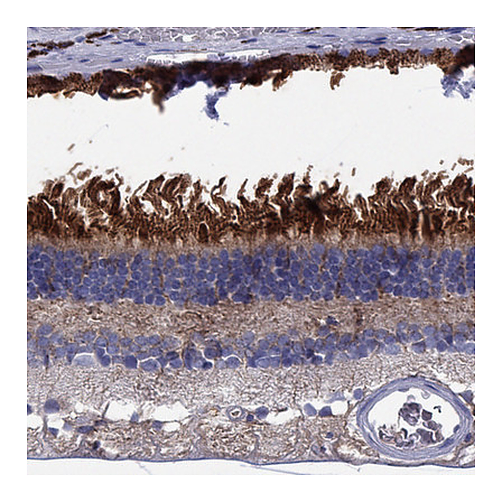 Atlas Antibodies Anti-BCO2 Antibody
