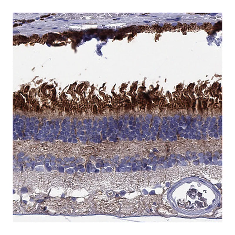 Atlas Antibodies Anti-BCO2 Antibody
