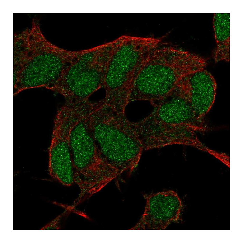 Atlas Antibodies Anti-BCOR Antibody