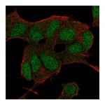 Atlas Antibodies Anti-BCOR Antibody