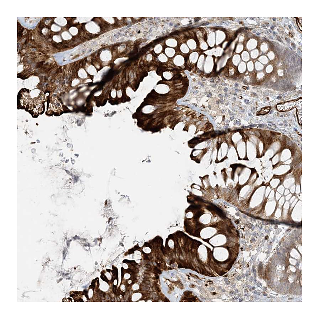 Atlas Antibodies Anti-BCORL1 Antibody