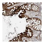 Atlas Antibodies Anti-BCORL1 Antibody