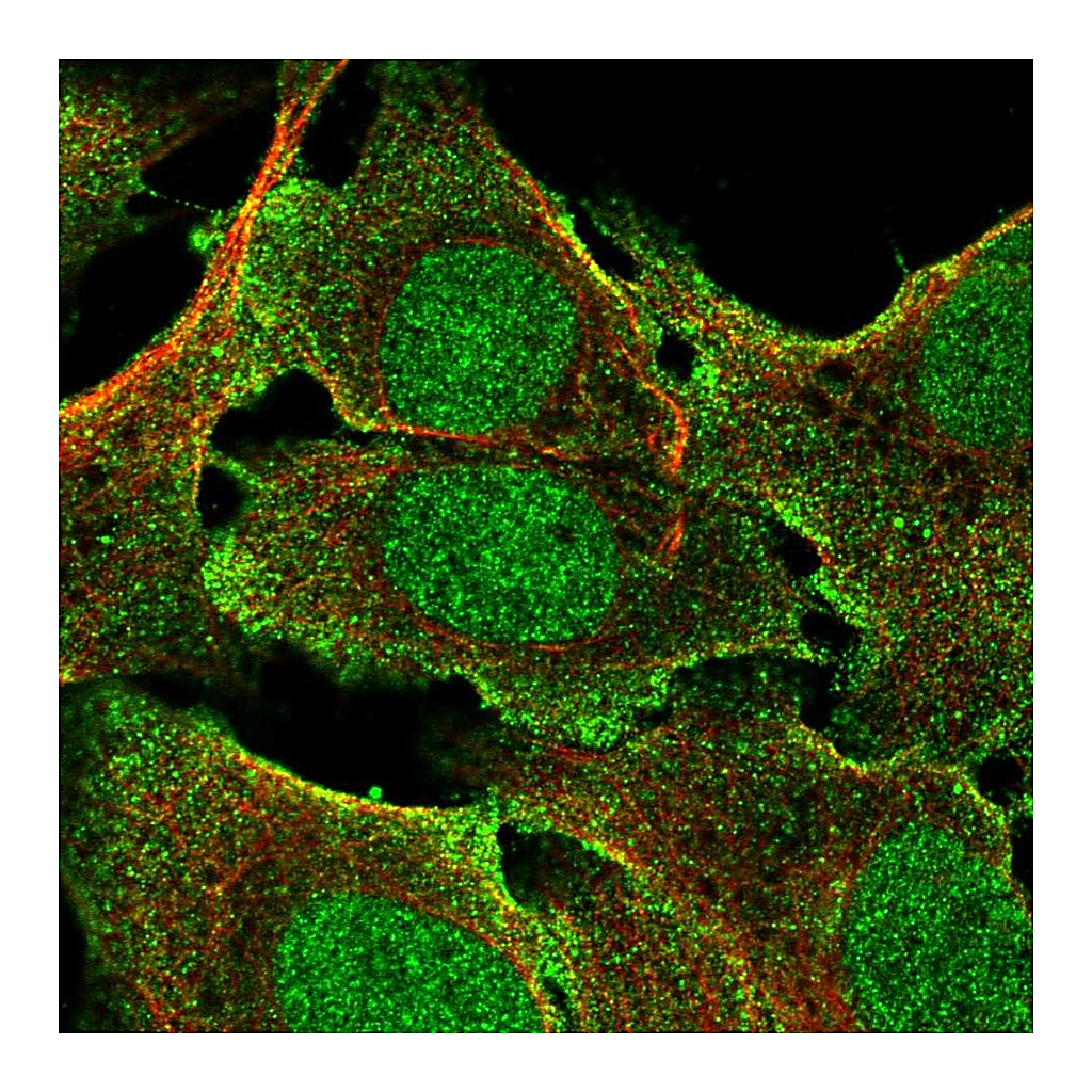 Atlas Antibodies Anti-BCORL1 Antibody