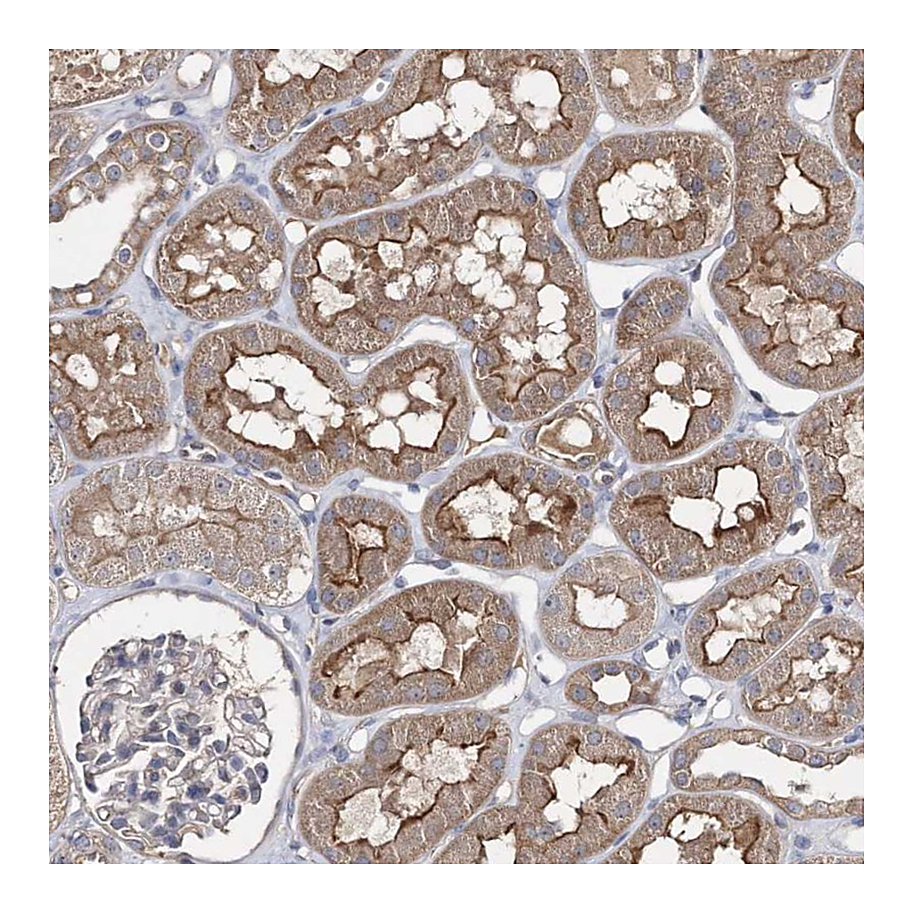 Atlas Antibodies Anti-BCR Antibody