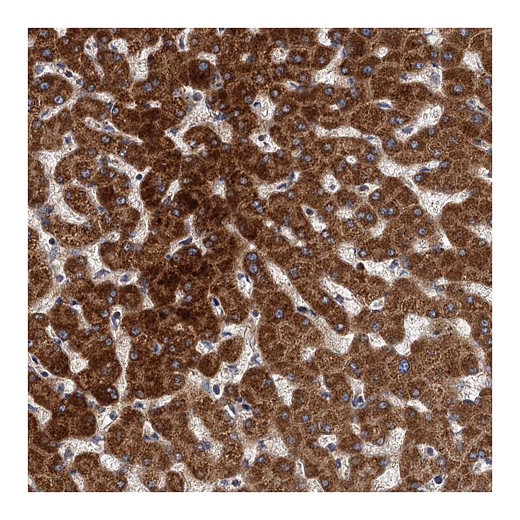 Atlas Antibodies Anti-BCS1L Antibody