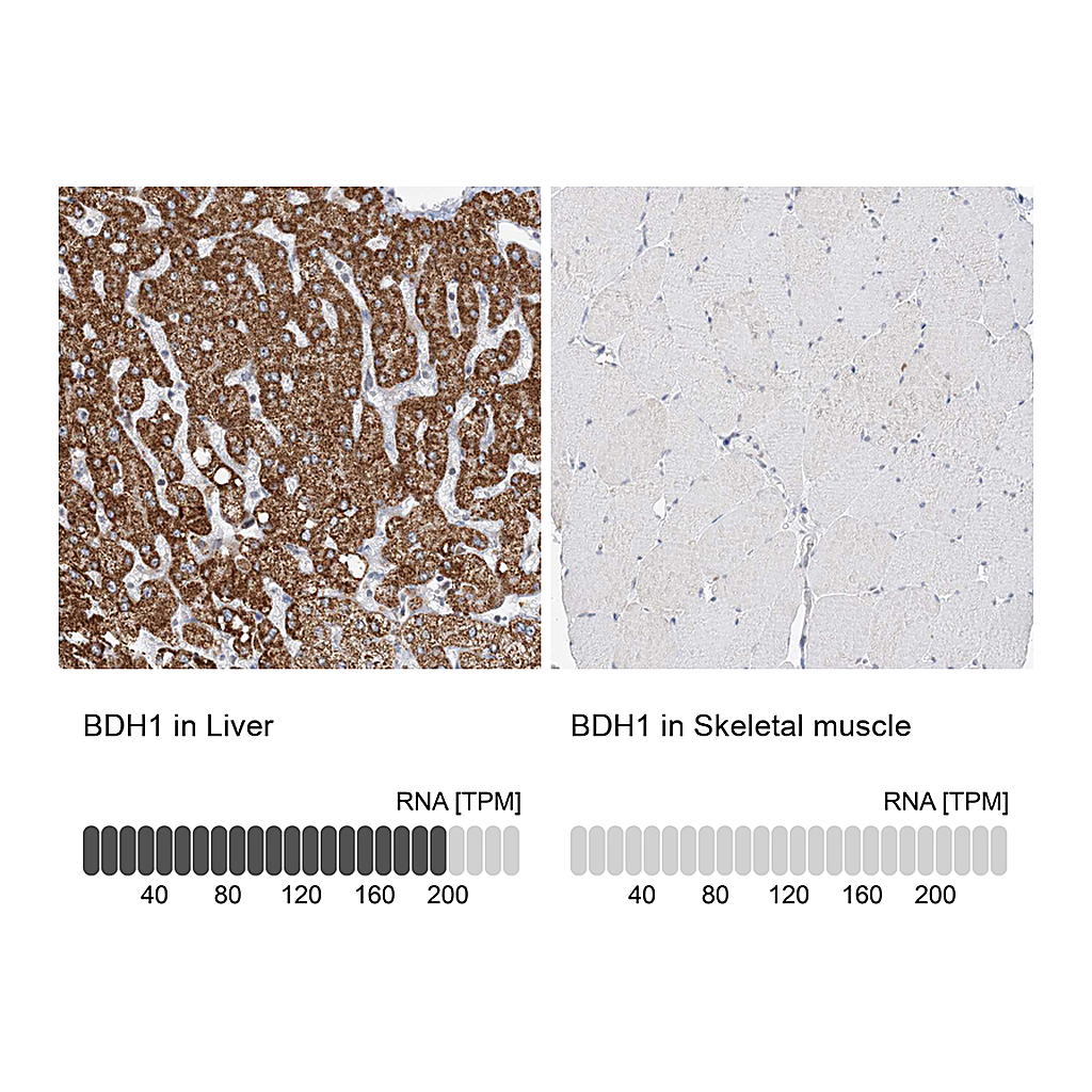 Atlas Antibodies Anti-BDH1 Antibody