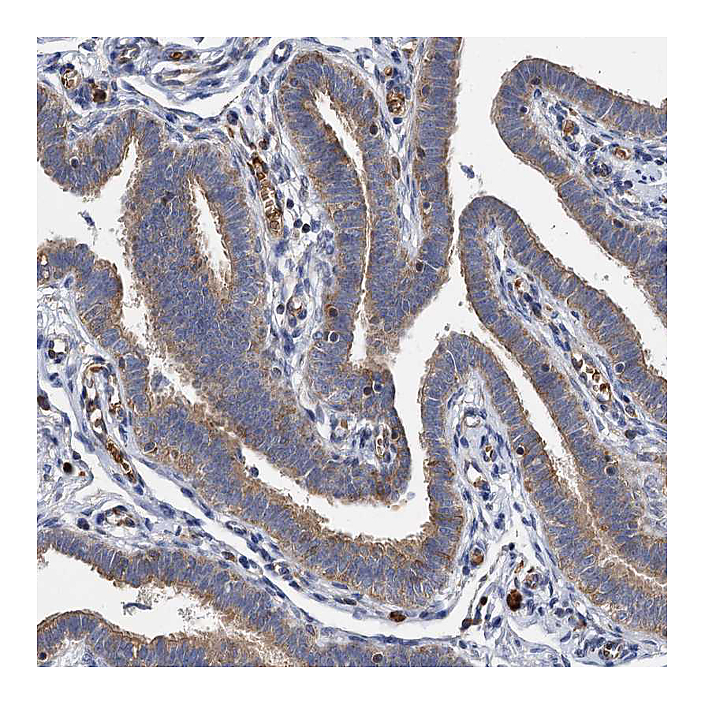 Atlas Antibodies Anti-BCS1L Antibody
