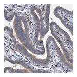 Atlas Antibodies Anti-BCS1L Antibody