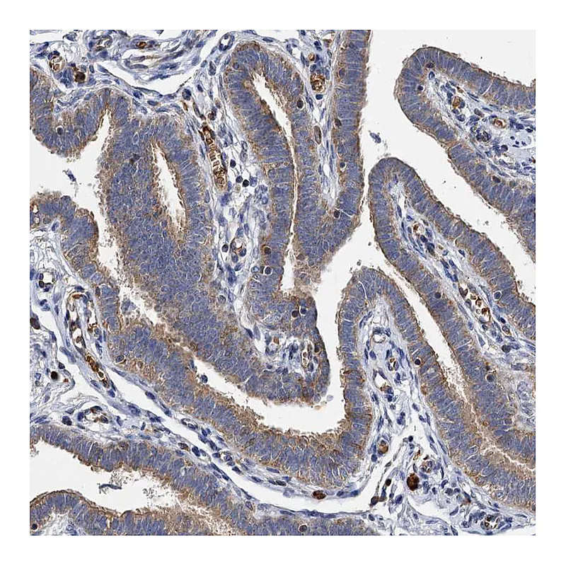 Atlas Antibodies Anti-BCS1L Antibody