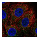 Atlas Antibodies Anti-BDH1 Antibody