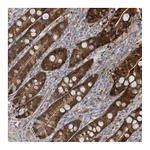 Atlas Antibodies Anti-BDH2 Antibody