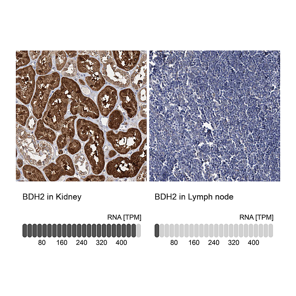 Atlas Antibodies Anti-BDH2 Antibody
