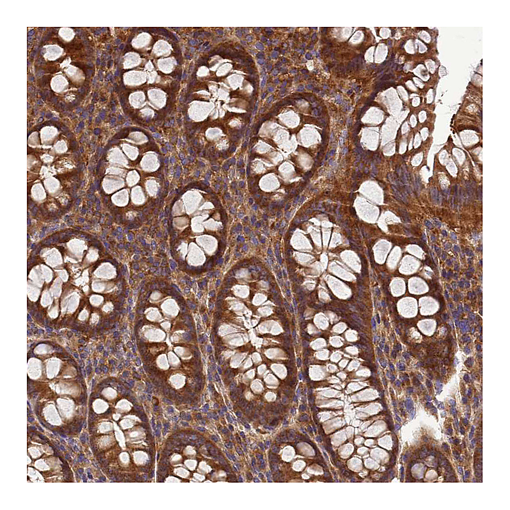 Atlas Antibodies Anti-BECN1 Antibody