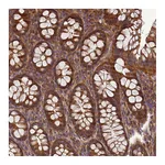 Atlas Antibodies Anti-BECN1 Antibody