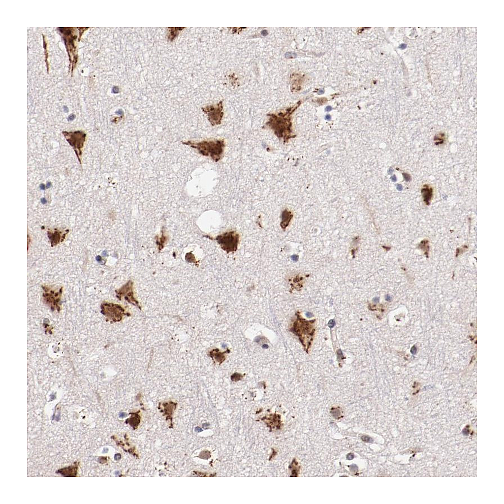 Atlas Antibodies Anti-BEGAIN Antibody