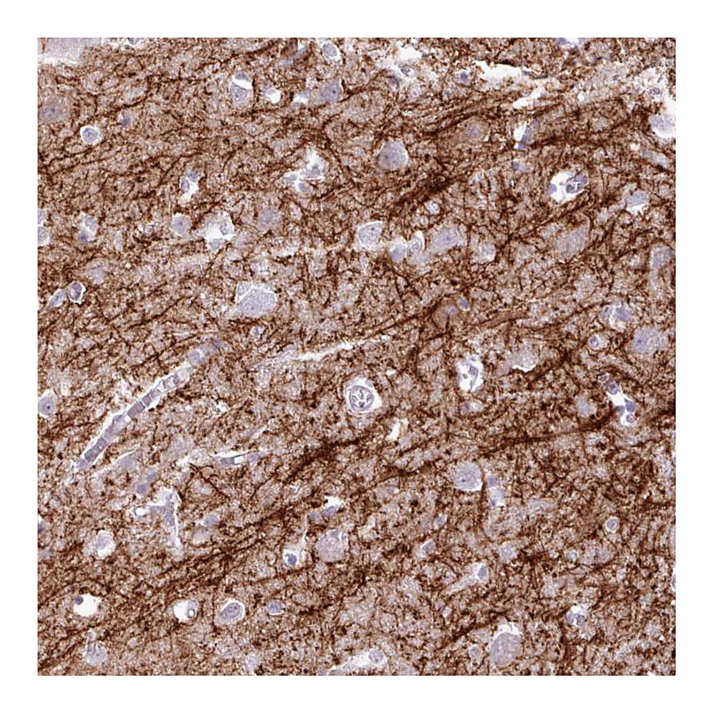 Atlas Antibodies Anti-BDKRB2 Antibody