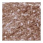 Atlas Antibodies Anti-BDKRB2 Antibody