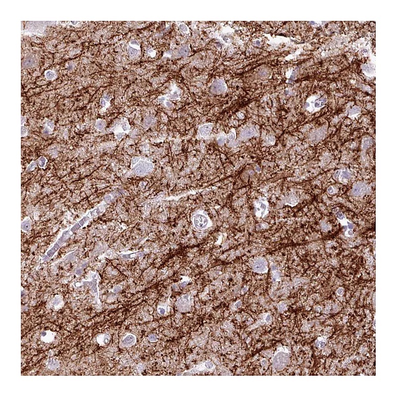 Atlas Antibodies Anti-BDKRB2 Antibody