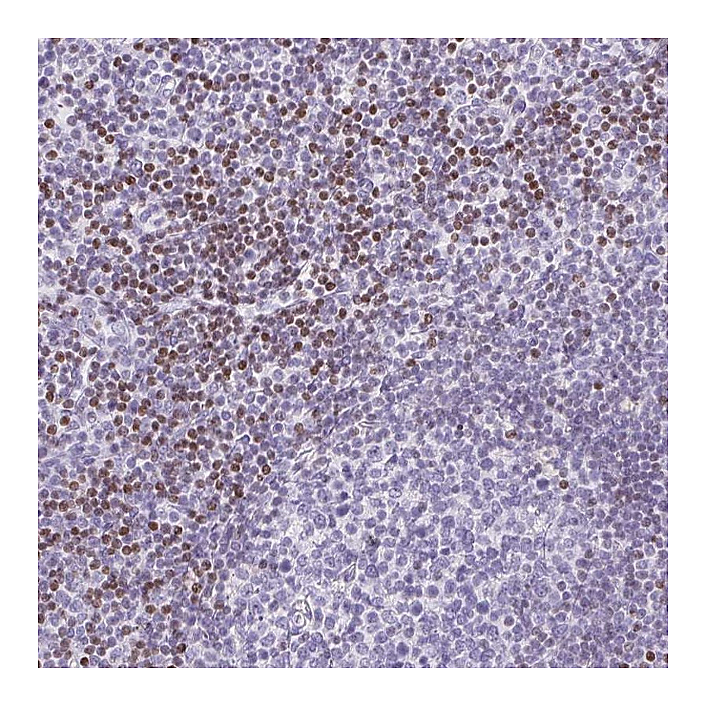 Atlas Antibodies Anti-BEND2 Antibody