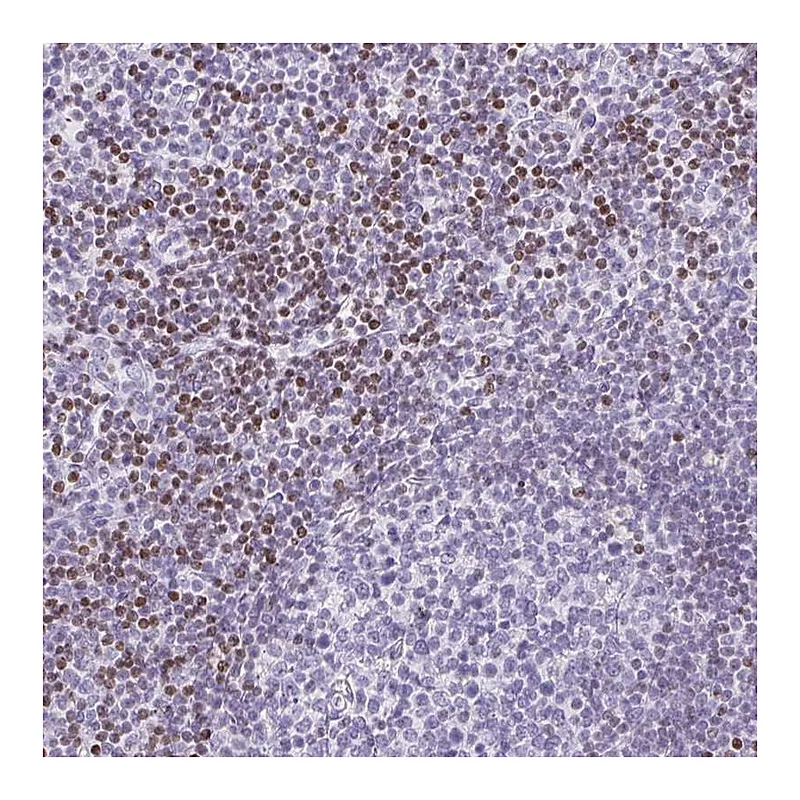 Atlas Antibodies Anti-BEND2 Antibody