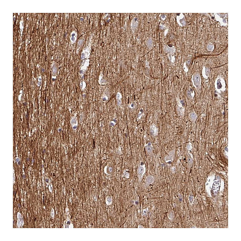 Atlas Antibodies Anti-BEND5 Antibody