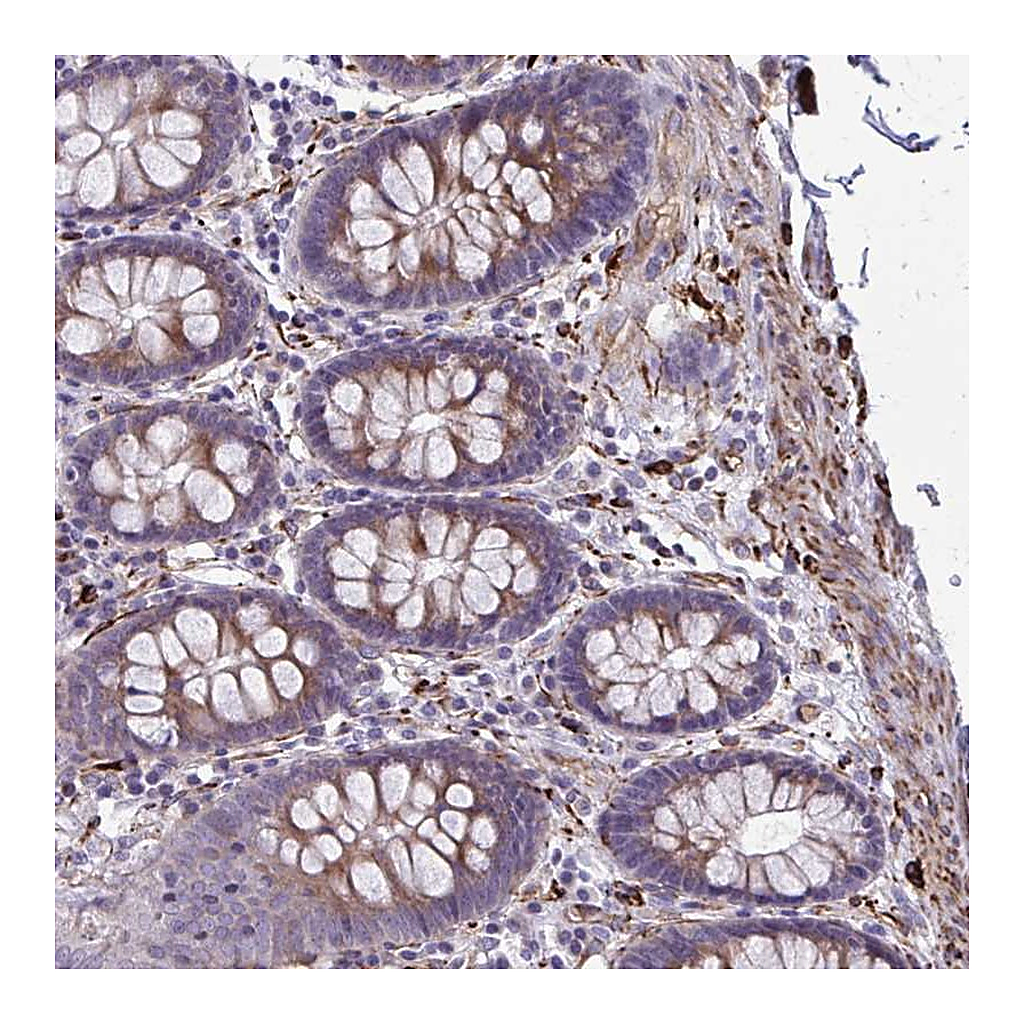 Atlas Antibodies Anti-BEND5 Antibody
