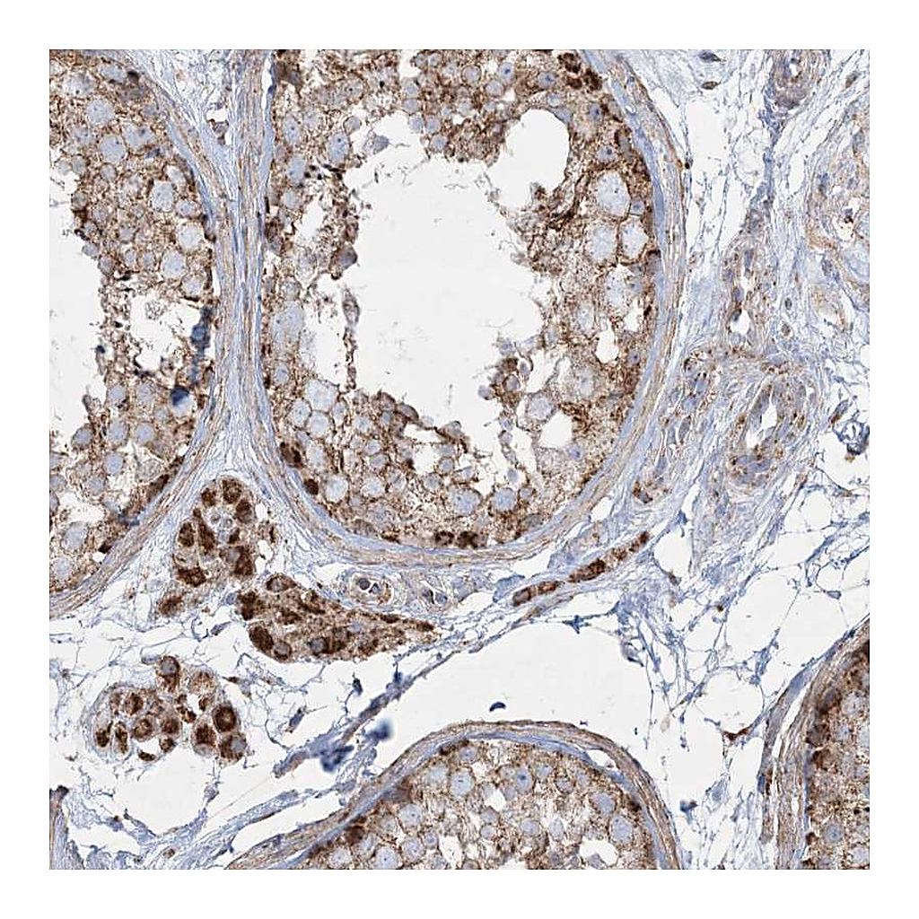 Atlas Antibodies Anti-BEND4 Antibody