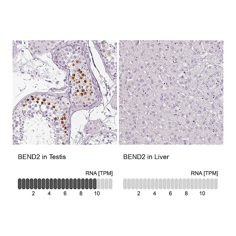 Atlas Antibodies Anti-BEND2 Antibody