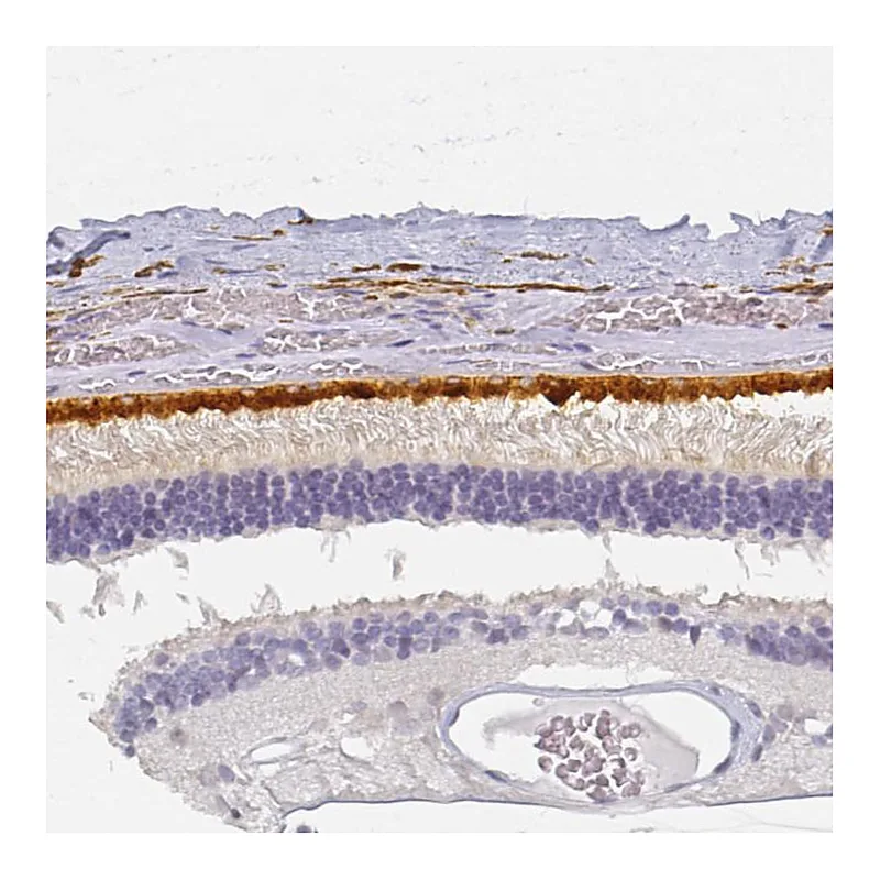 Atlas Antibodies Anti-BEST1 Antibody