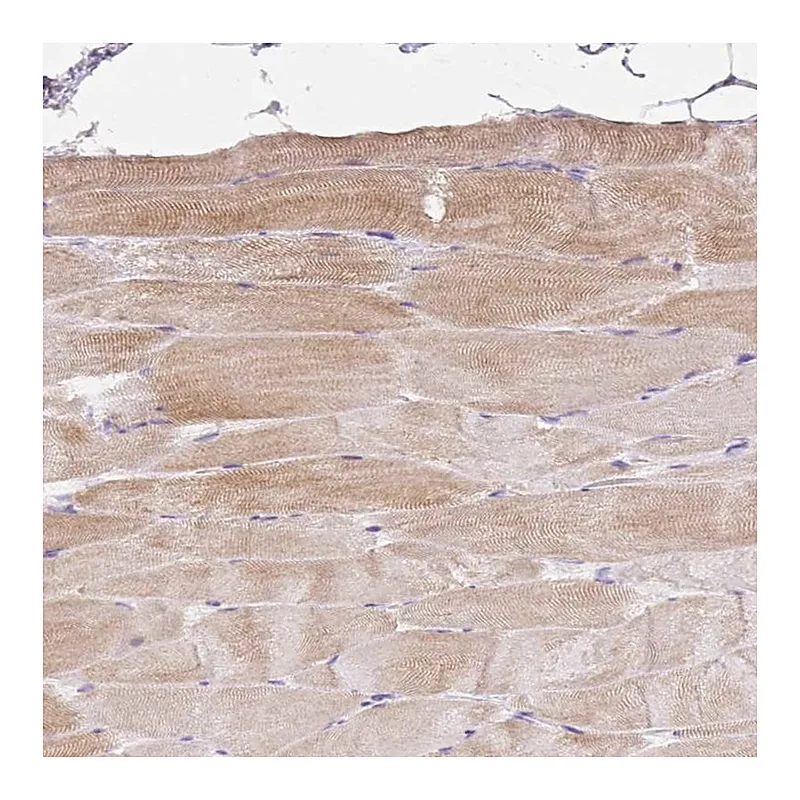 Atlas Antibodies Anti-BEST3 Antibody