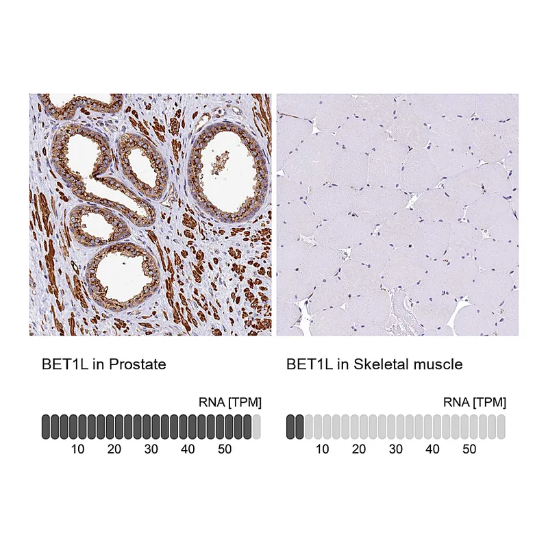 Atlas Antibodies Anti-BET1L Antibody