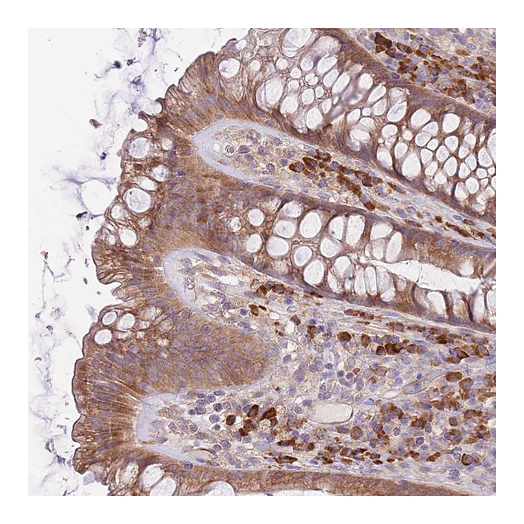 Atlas Antibodies Anti-BEX2 Antibody