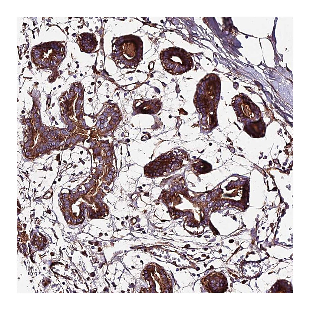 Atlas Antibodies Anti-BEX4 Antibody