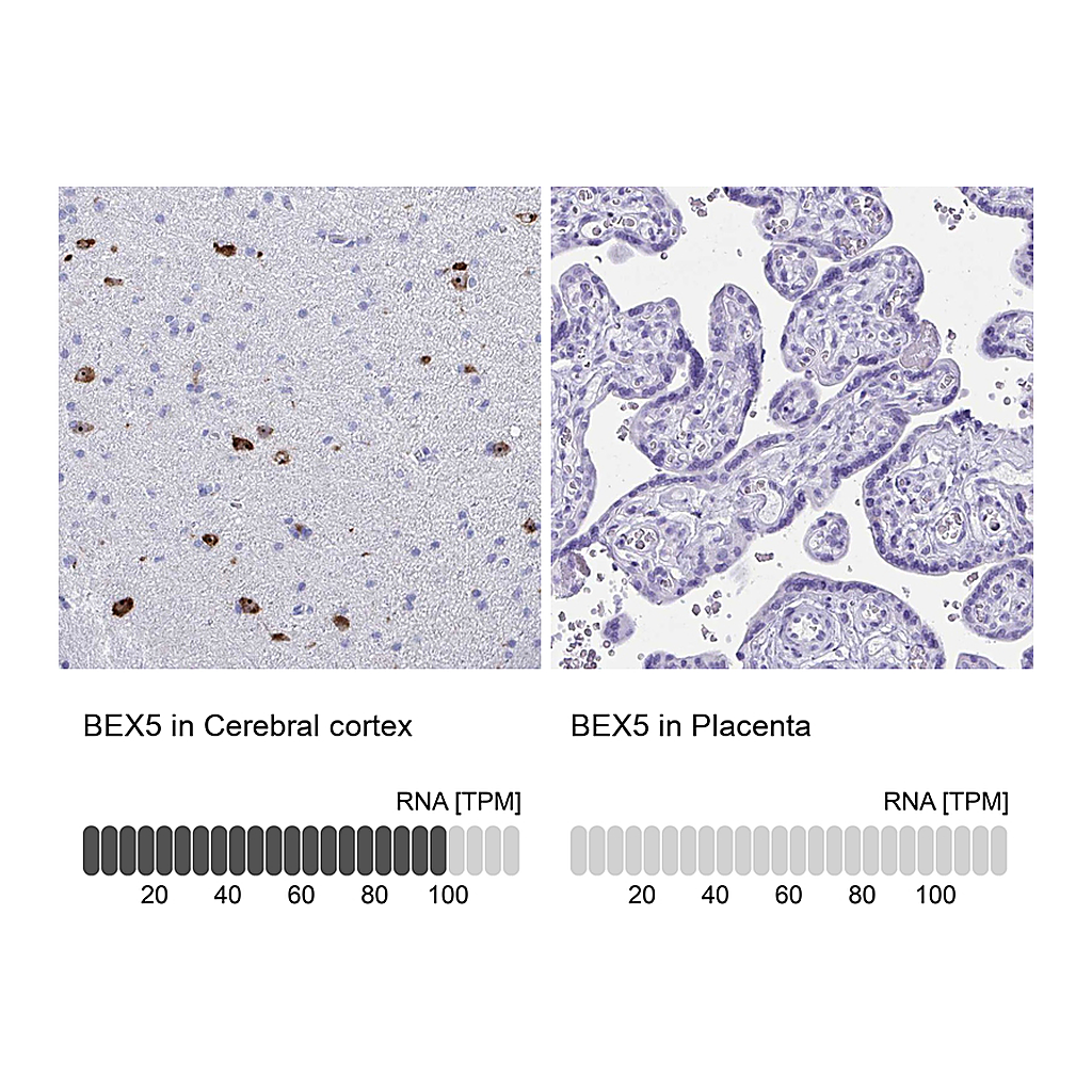 Atlas Antibodies Anti-BEX5 Antibody
