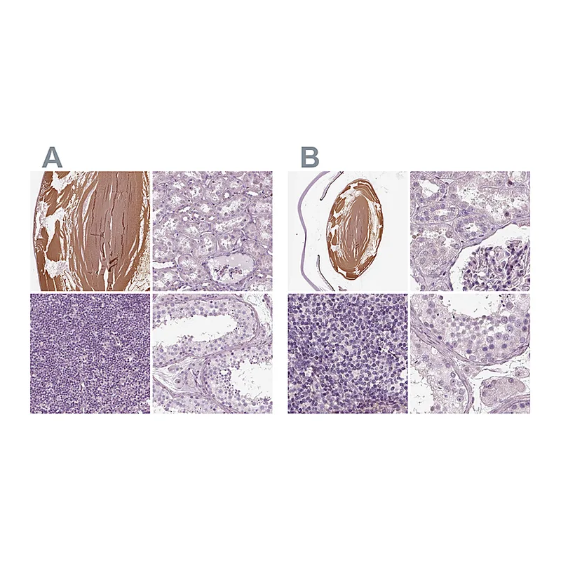 Atlas Antibodies Anti-BFSP1 Antibody