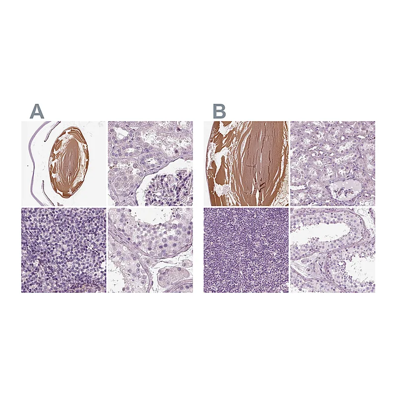 Atlas Antibodies Anti-BFSP1 Antibody