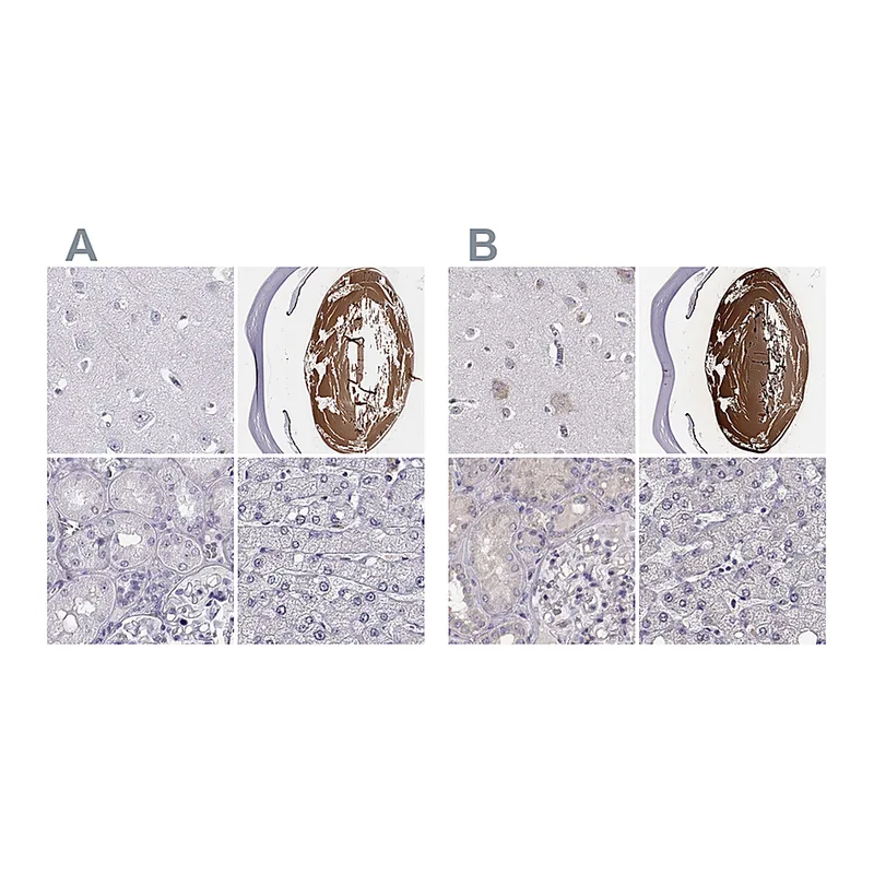 Atlas Antibodies Anti-BFSP2 Antibody