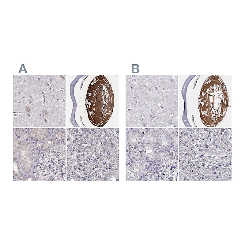 Atlas Antibodies Anti-BFSP2 Antibody