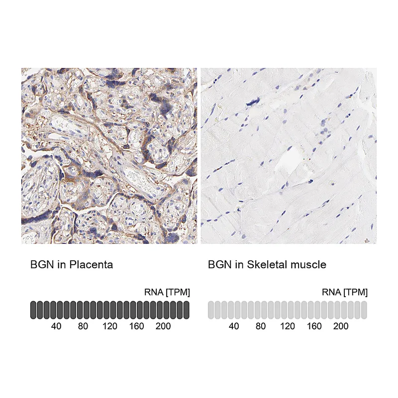Atlas Antibodies Anti-BGN Antibody