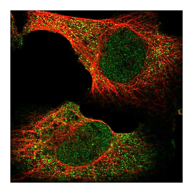 Atlas Antibodies Anti-BHLHB9 Antibody