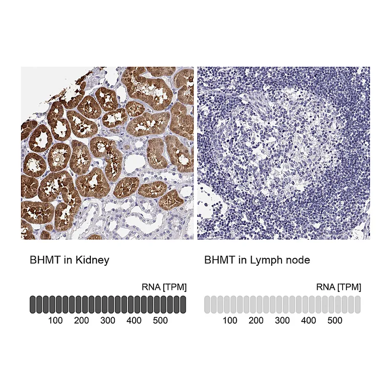 Atlas Antibodies Anti-BHMT Antibody