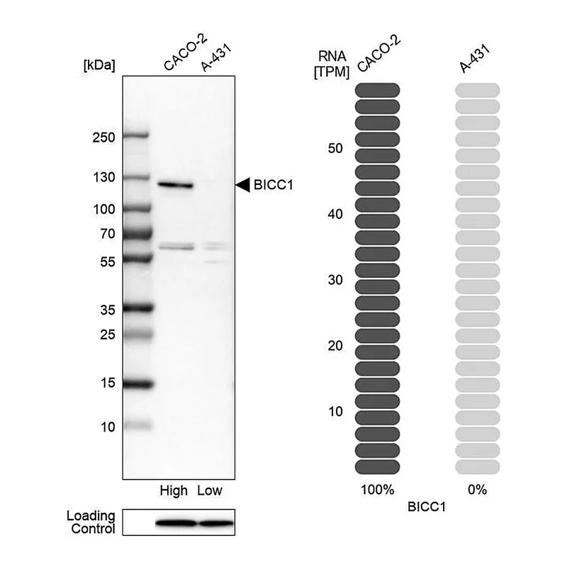 Atlas Antibodies Anti-BICC1 Antibody