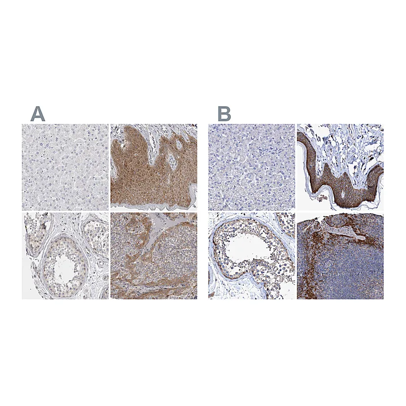 Atlas Antibodies Anti-BICD2 Antibody