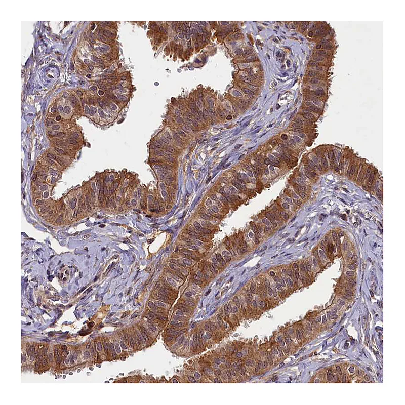 Atlas Antibodies Anti-BICD1 Antibody
