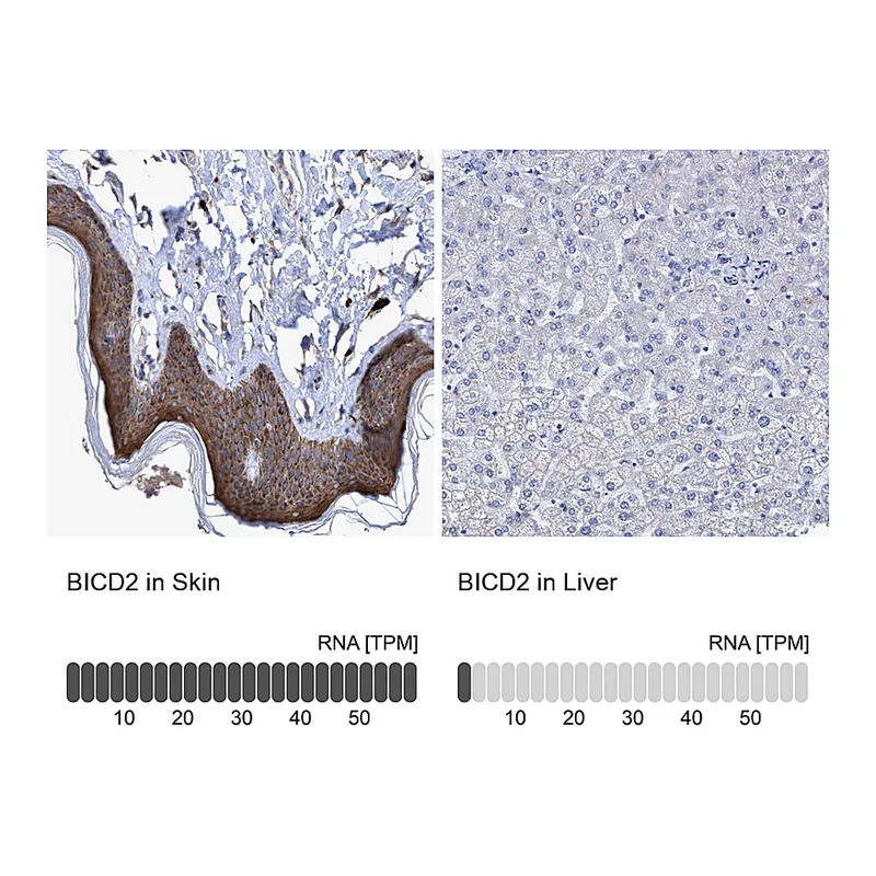 Atlas Antibodies Anti-BICD2 Antibody