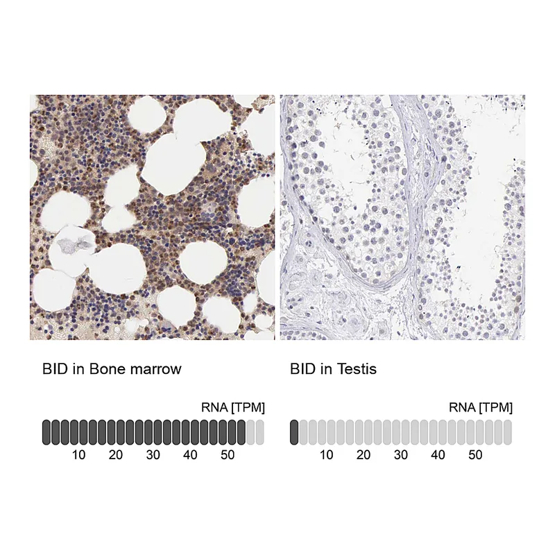 Atlas Antibodies Anti-BID Antibody