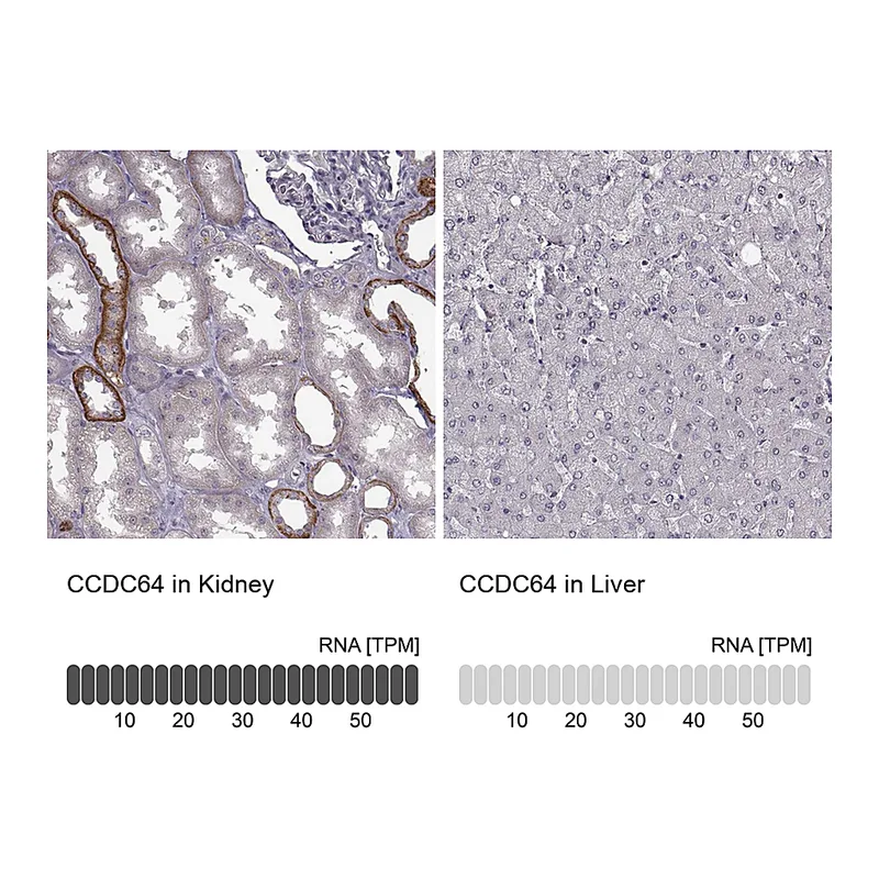 Atlas Antibodies Anti-BICDL1 Antibody