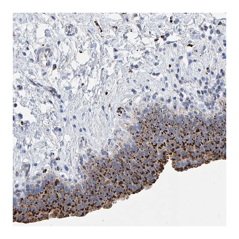 Atlas Antibodies Anti-BIN3 Antibody